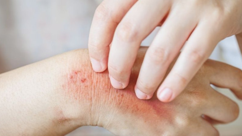 Ebafit 10 mg nedir, ne işe yarar, kimler kullanır ve fiyatı ne kadar?