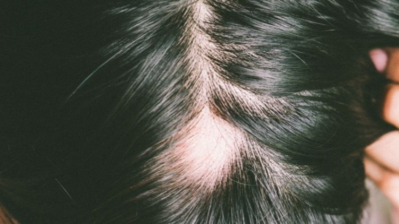 Biotin hangi vitamin nedir, ne işe yarar ve kimler kullanır? Fiyatı ve kullanım talimatı..