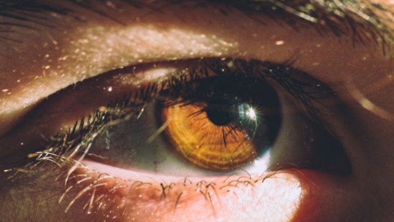 Göz, dudak, saç ve saç derisi kuruluğu nasıl geçer? Evde nasıl düzelir?